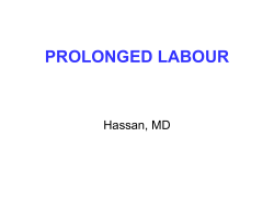 PROLONGED LABOUR Hassan, MD