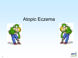 Atopic Eczema 1