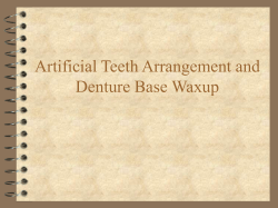 Artificial Teeth Arrangement and Denture Base Waxup
