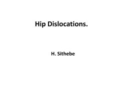 Hip Dislocations. H. Sithebe