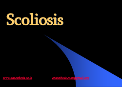 Scoliosis www.anaesthesia.co.in