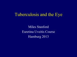 Tuberculosis and the Eye Miles Stanford Euretina Uveitis Course Hamburg 2013