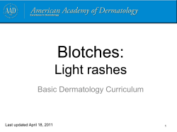 Blotches: Light rashes Basic Dermatology Curriculum Last updated April 18, 2011