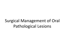 Surgical Management of Oral Pathological Lesions