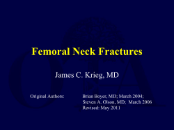 Femoral Neck Fractures James C. Krieg, MD Original Authors: