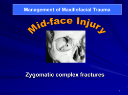 Zygomatic complex fractures Management of Maxillofacial Trauma 1
