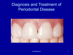 Diagnosis and Treatment of Periodontal Disease dr shabeel pn 1