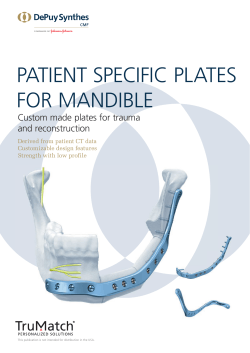 PATIENT SPECIFIC PLATES FOR MANDIBLE Custom made plates for trauma and  reconstruction