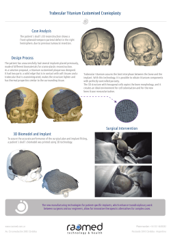 Trabecular Titanium Customised Cranioplasty Case Analysis