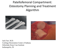 Patellofemoral Compartment: Osteotomy Planning