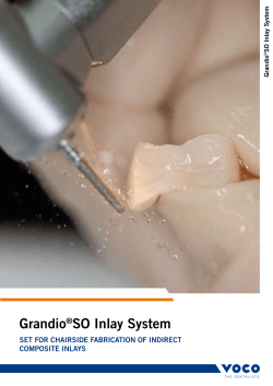 Grandio®So inlay System