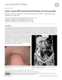Colonic Lipoma With Gastrointestinal Bleeding and Intussusception