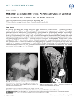 Malignant Coloduodenal Fistula: An Unusual Cause of Vomiting