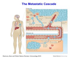 The Metastatic Cascade - Innovation in Breast Cancer