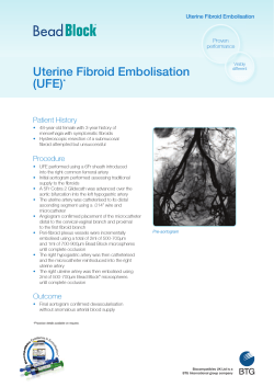 Uterine Fibroid Embolisation (UFE)*