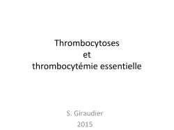 Thrombocytoses et thrombocytÃ©mie essentielle