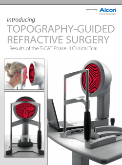 TOPOGRAPHY-GUIDED REFRACTIVE SURGERY