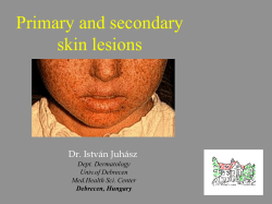 Primary and secondary skin lesions