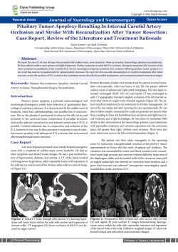 Pituitary Tumor Apoplexy Resulting In Internal Carotid Artery