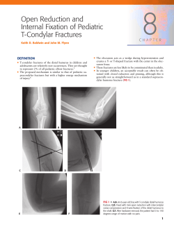 Open Reduction and Internal Fixation of Pediatric T