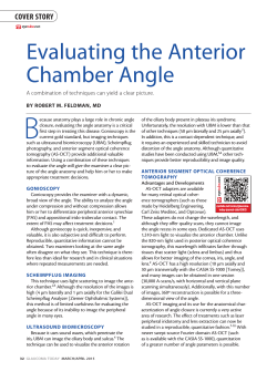 Evaluating the Anterior Chamber Angle