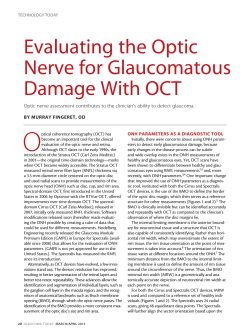 Evaluating the Optic Nerve for Glaucomatous