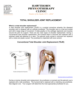total shoulder joint replacement