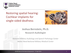 Cochlear implants for single