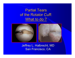 Partial Tears of the Rotator Cuff: What to do?