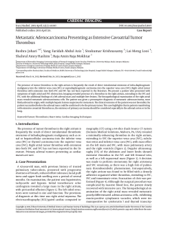 Metastatic Adenocarcinoma Presenting as Extensive Cavoatrial