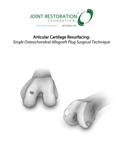 Articular Cartilage Resurfacing Single OCA Plug