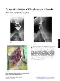 Perioperative Images of Cricopharyngeal Achalasia