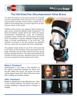 The OA KneeTrac Decompression Knee Brace