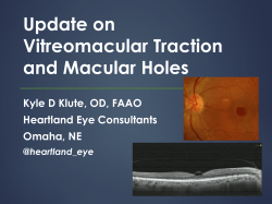 Idiopathic Macular Hole Classification Revisited