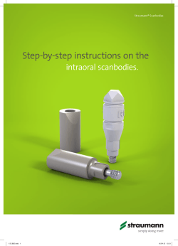 Step-by-step instructions on the intraoral scanbodies.