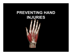 PREVENTING HAND INJURIES