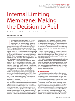 Internal Limiting Membrane: Making the Decision to