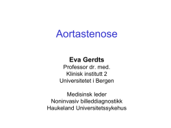 Aortastenose - Mitt UiB - Universitetet i Bergen