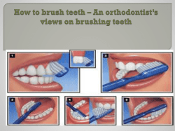 How to brush teeth – An orthodontist’s views on brushing teeth