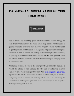 Painless and Simple Varicose Vein Treatment
