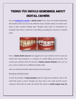 Things You Should Remember About Dental Crowns
