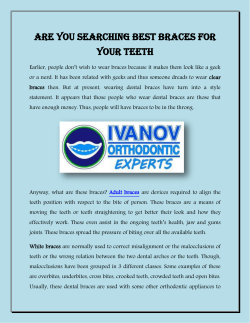 Are You Searching Best Braces for Your Teeth