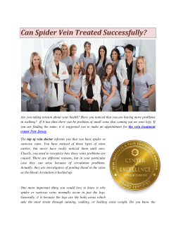 Can Spider Vein Treated Successfully