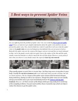 5 Best ways to prevent Spider Veins