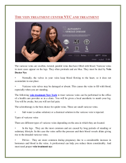 The vein treatment center NYC and treatment