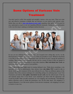 Some Options of Varicose Vein Treatment