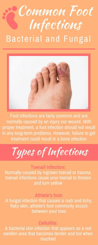 common foot infections backterial and fungal - Certified Foot