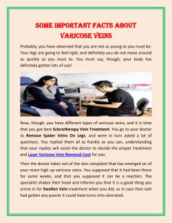 Some Important Facts About Varicose Veins