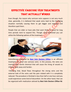 Effective Varicose Vein Treatments That Actually Works (1)