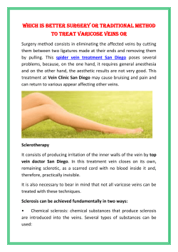 Spider veins treatments what works and what doesn’t